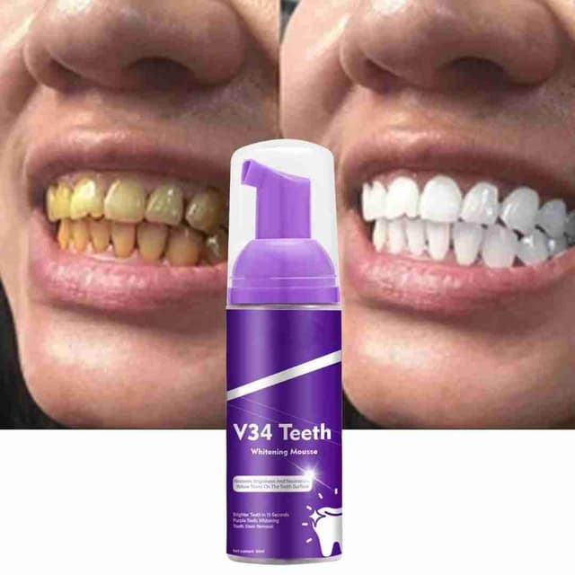 Gel de blanchiment dentaire professionnel