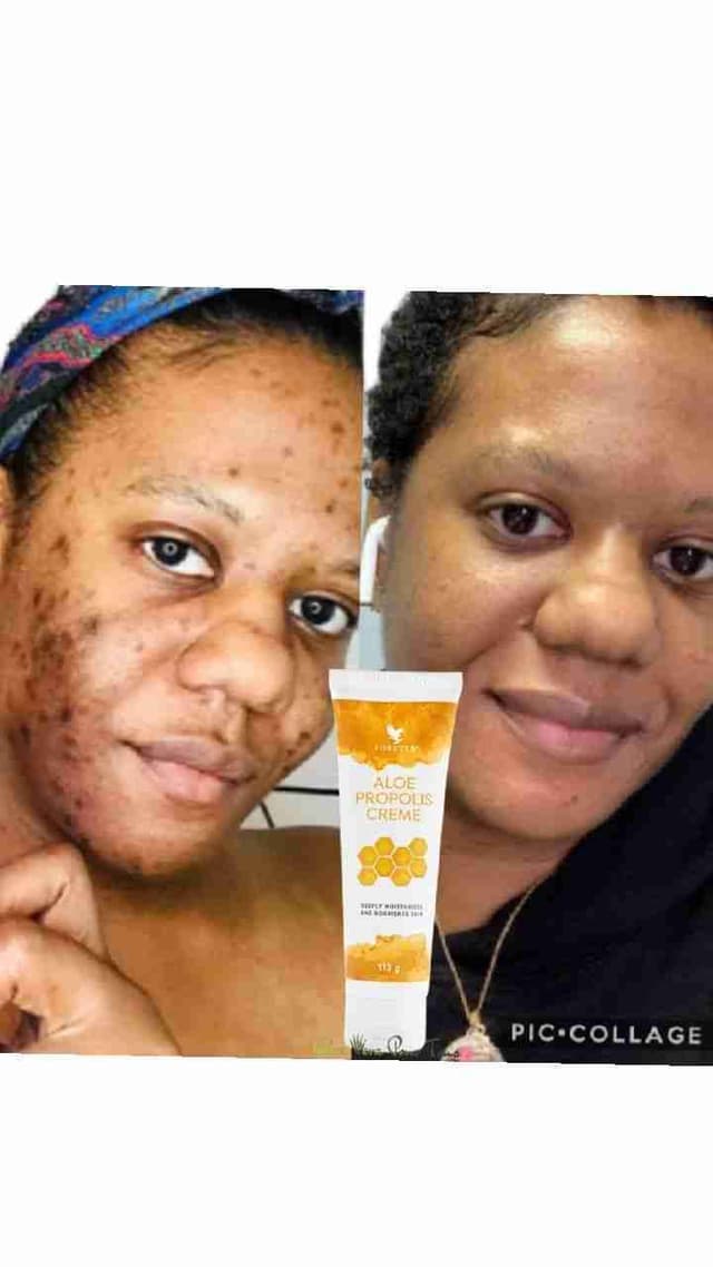 Propolis creme
