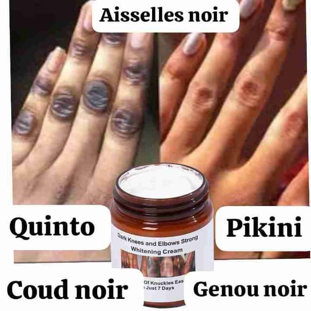 Crème pour les tâches noires